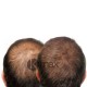 Kmax Kuracja Wzrostu Włosów Porost Włosów Stymulacja Wzrostu Włosów 3 produkty